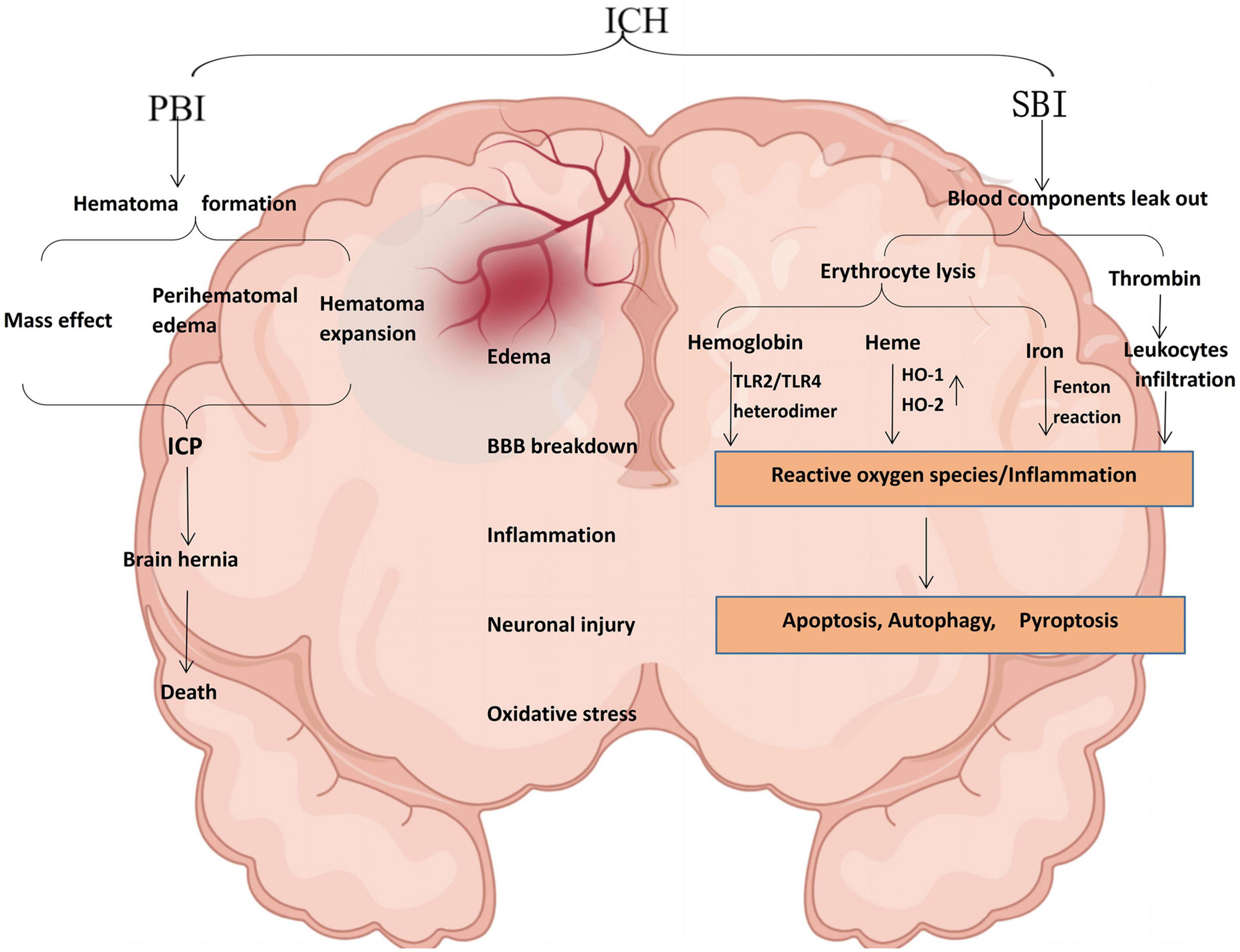 Autophagy regulates inflammation in intracerebral hemorrhage: Enemy or friend?